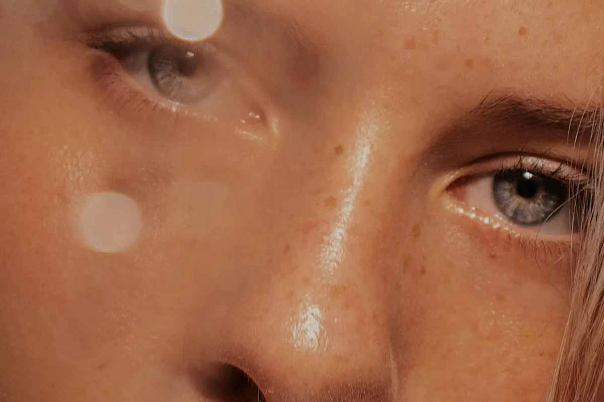 Primer plano de piel con pecas, fotografía ilustrativa